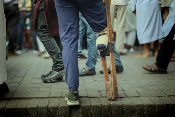 Rénovation d'ampleur : transformez votre habitat avec expertise